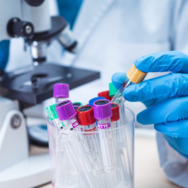 Pruebas-de-Laboratorio-Clínico-CQS-LAB-scaled